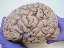 “Understanding Brain Shutdown: Causes and Consequences”